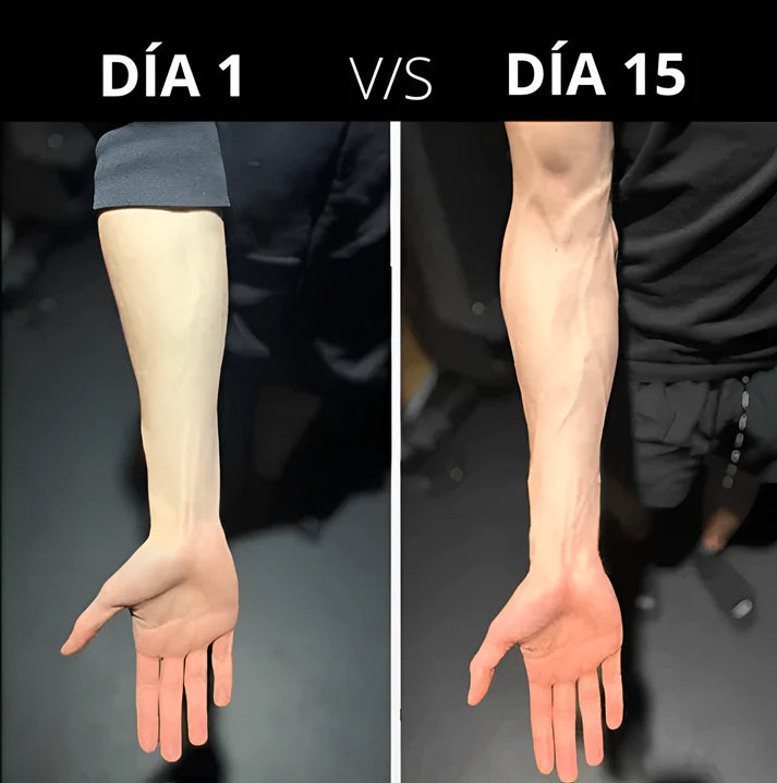 Kit Hand Grip Dedos Mano Muñeca Brazo
